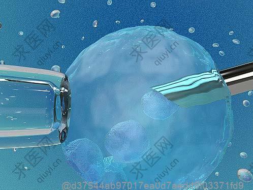 石河子干细胞治疗肌病医院