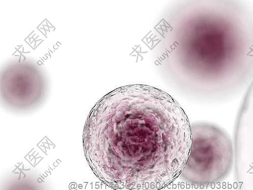 做甲状腺彩超4a及淋巴结2cm