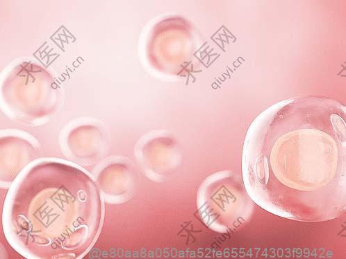 CT检查肺部纤维条索影是什么原因